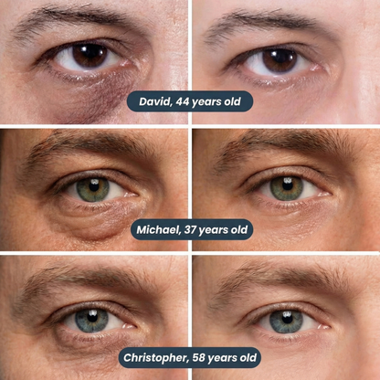 Liftora EyeLift Patches
